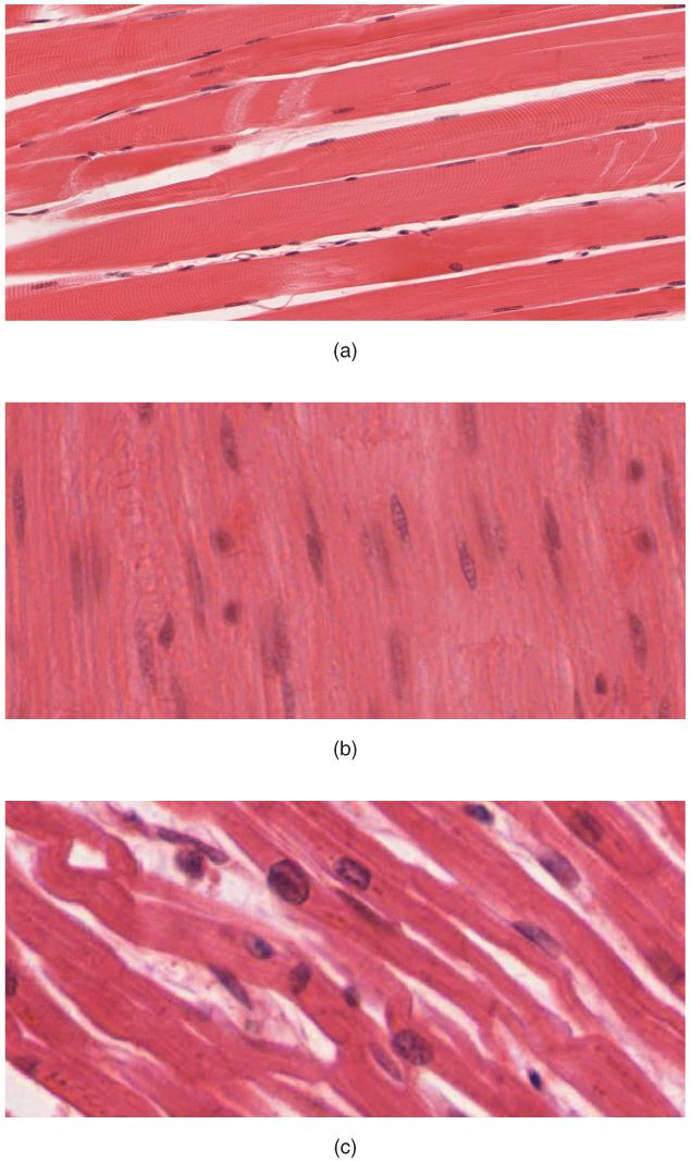 The three types of muscle tissue reference figure