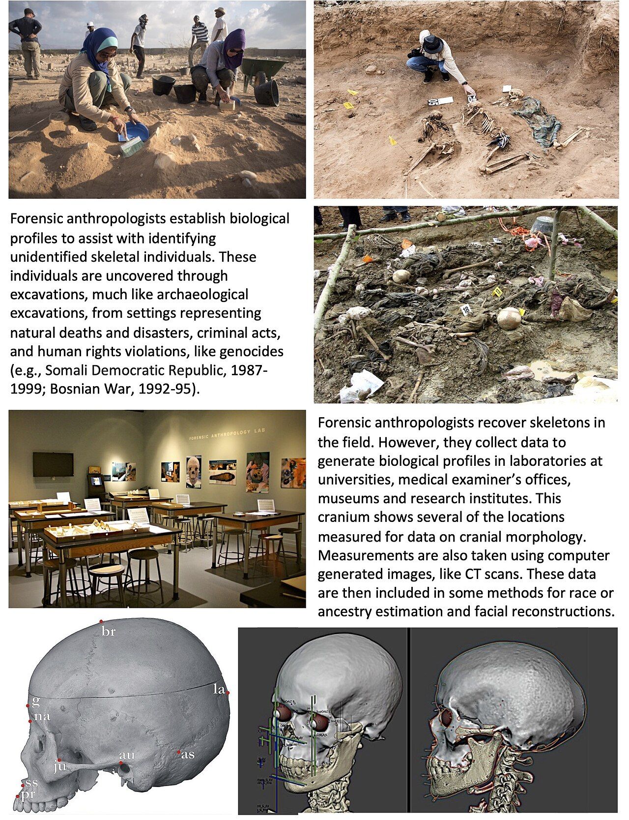 Forensic anthropology: skeletal remains laid out for analysis and identification