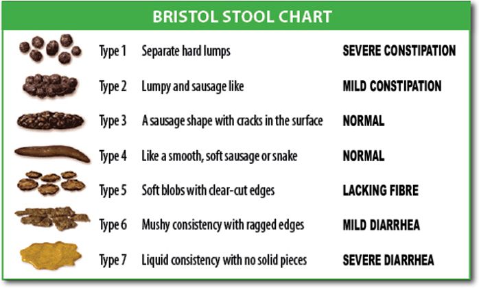 The Bristol Stool Form Scale, a seven-type classification that turns a subjective description of stool into a documentable, communicable finding.