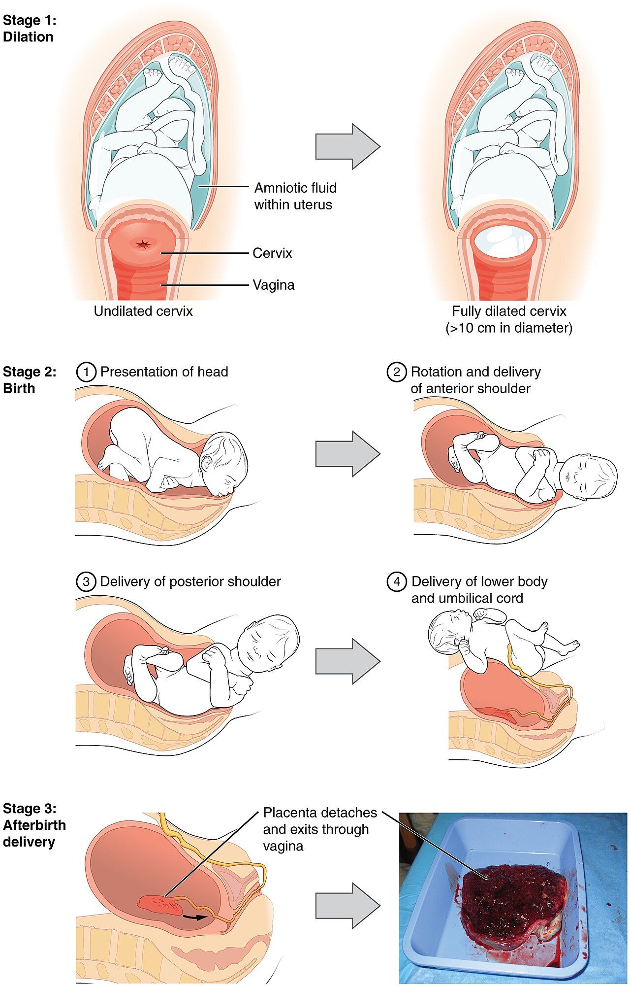 The stages of childbirth, from full dilation through delivery of the baby and the placenta