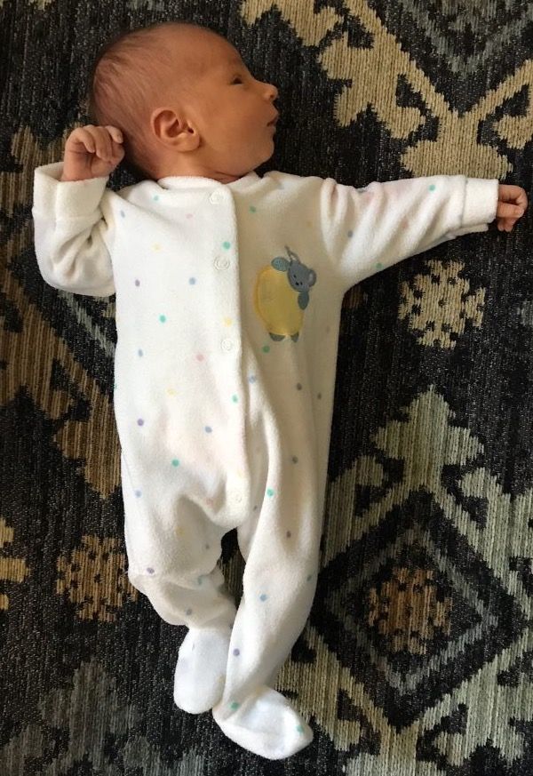 A young infant showing the asymmetrical tonic neck reflex, one arm extended toward the side the head is turned
