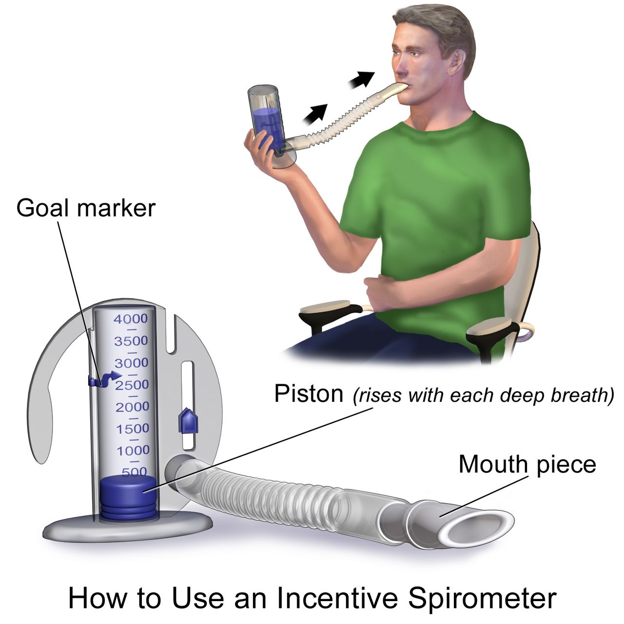 A patient seated on the edge of a hospital bed using a handheld incentive spirometer while a nurse steadies the device