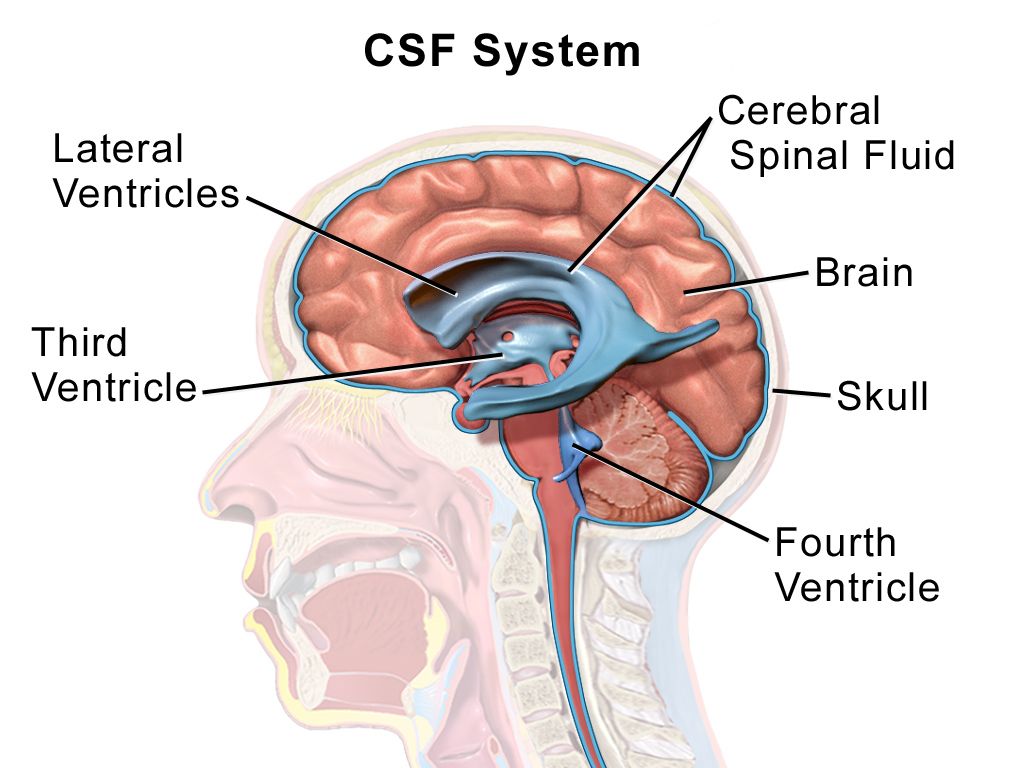 Illustration of the rigid cranial vault containing brain tissue, blood and cerebrospinal fluid, with arrows showing midline shift and downward uncal and tonsillar herniation