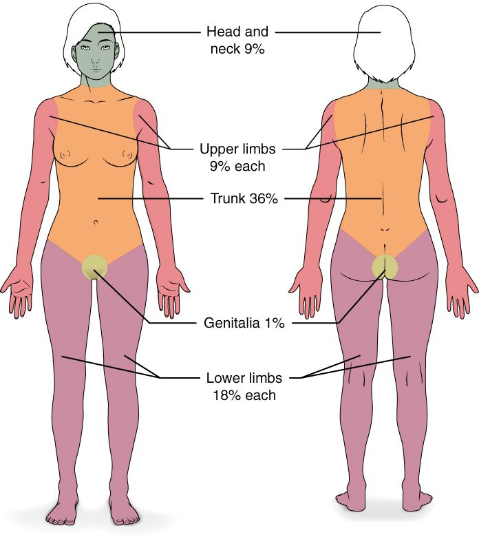 The Rule of Nines for rapid burn surface-area estimation, with the paediatric modification for the proportionally larger head.