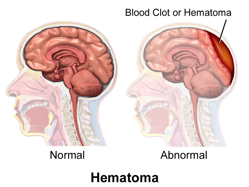 Comparison diagram of the human brain showing regions responsible for attention, memory, language and executive function