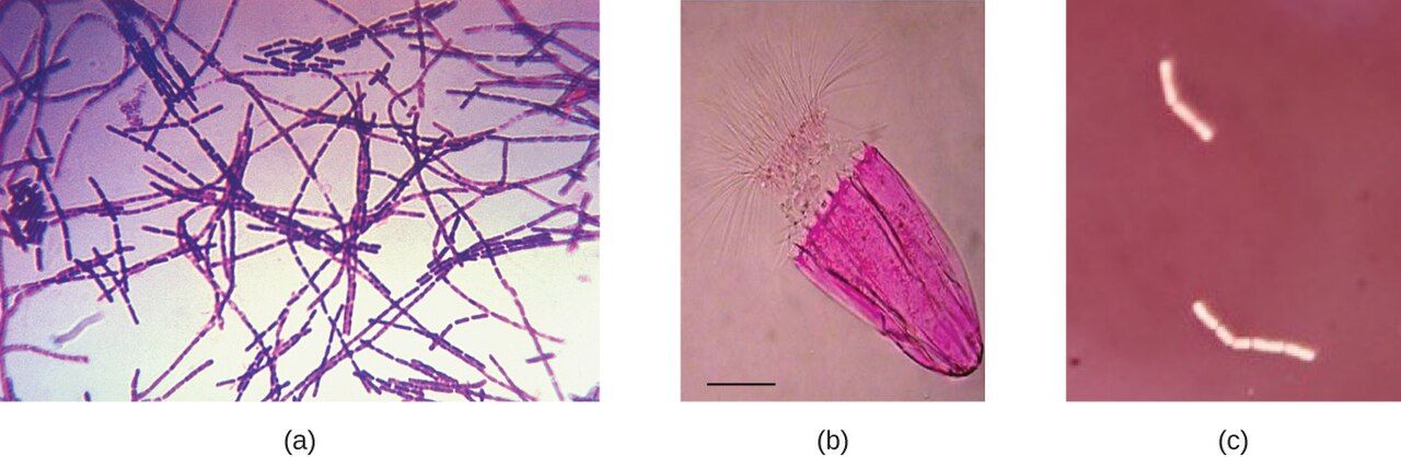 Comparison of positive staining, which colors the cells, and negative staining, which colors the background
