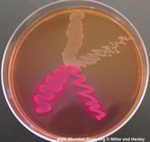 Selective and differential agar plates growing bacterial colonies