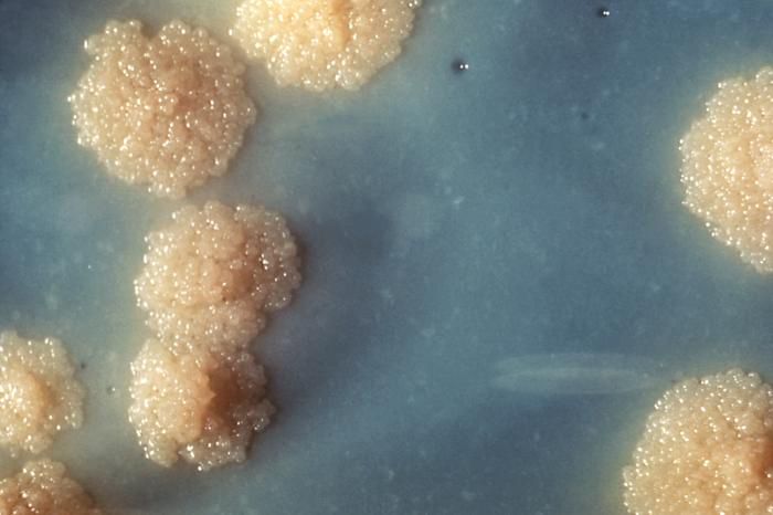 Mycobacterium tuberculosis, acid-fast bacilli that resist ordinary staining