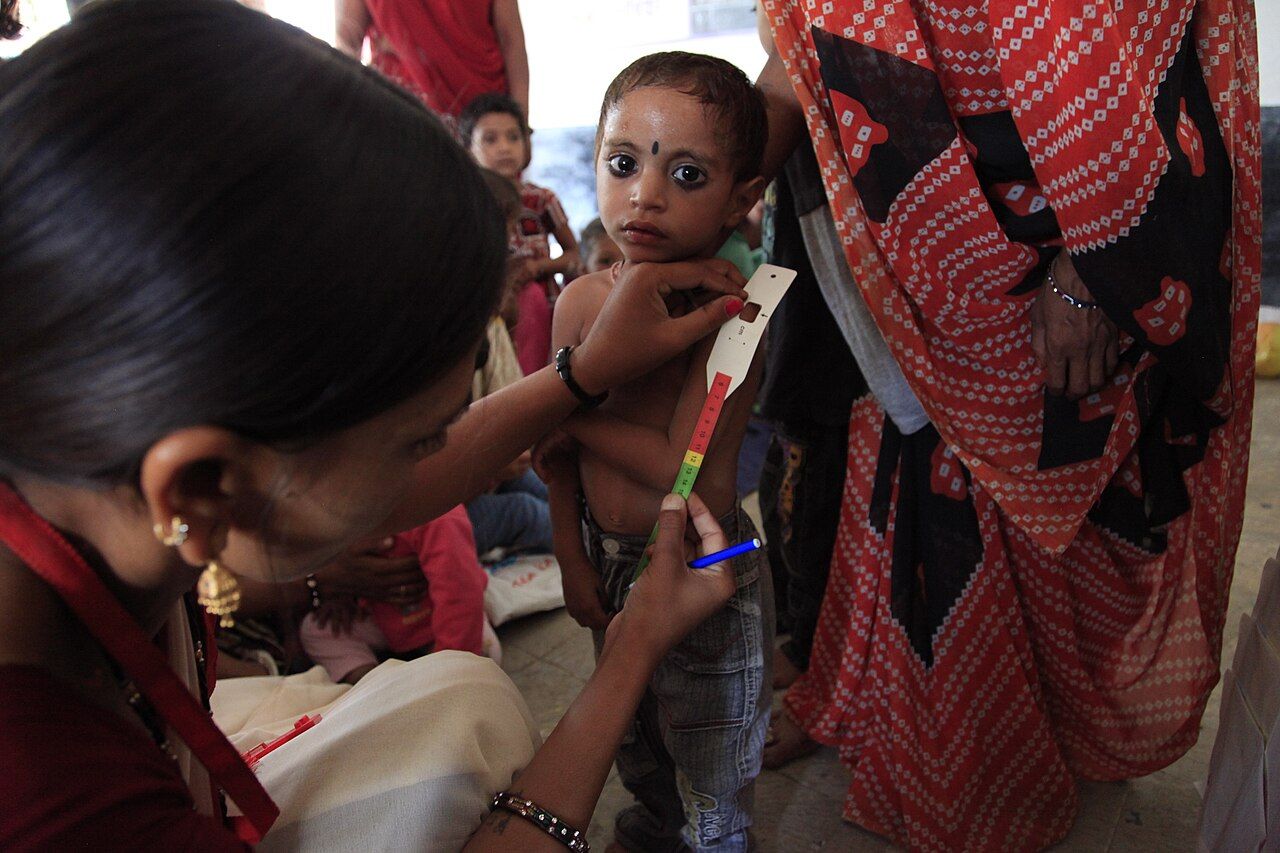 A health worker using a measuring tape to take an arm circumference measurement
