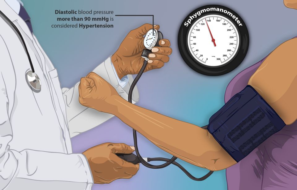 Hypertension reference figure