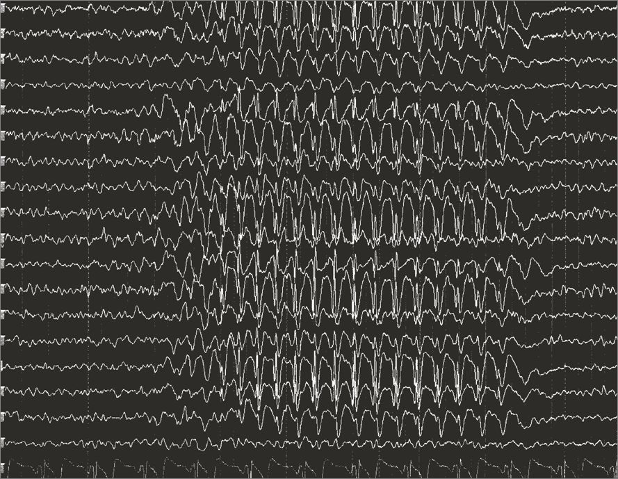 Seizures & epilepsy reference figure