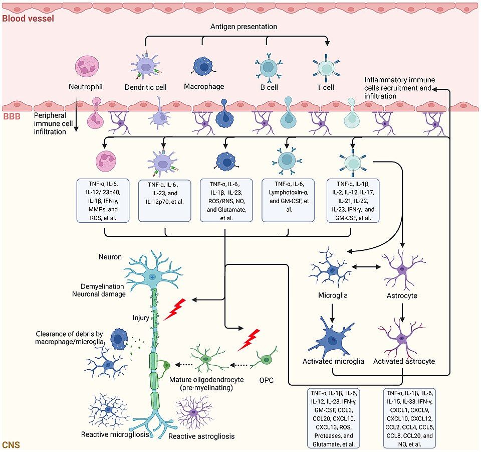 Demyelinating disease reference figure