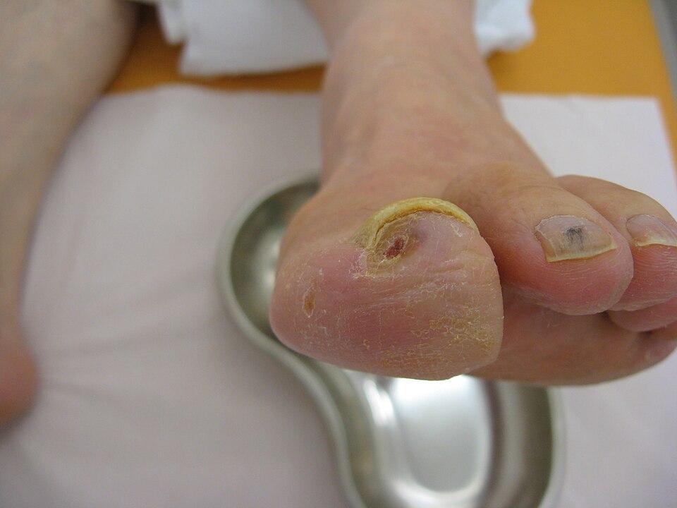 Reference figure for peripheral vascular disease