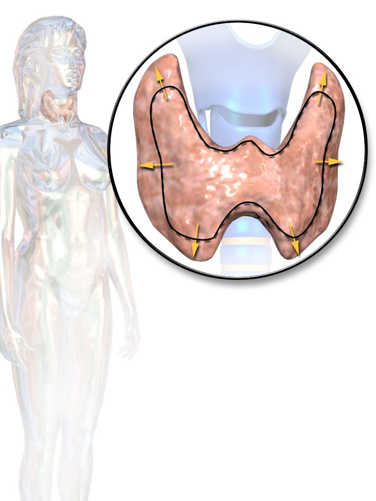 Reference figure for thyroid disorders