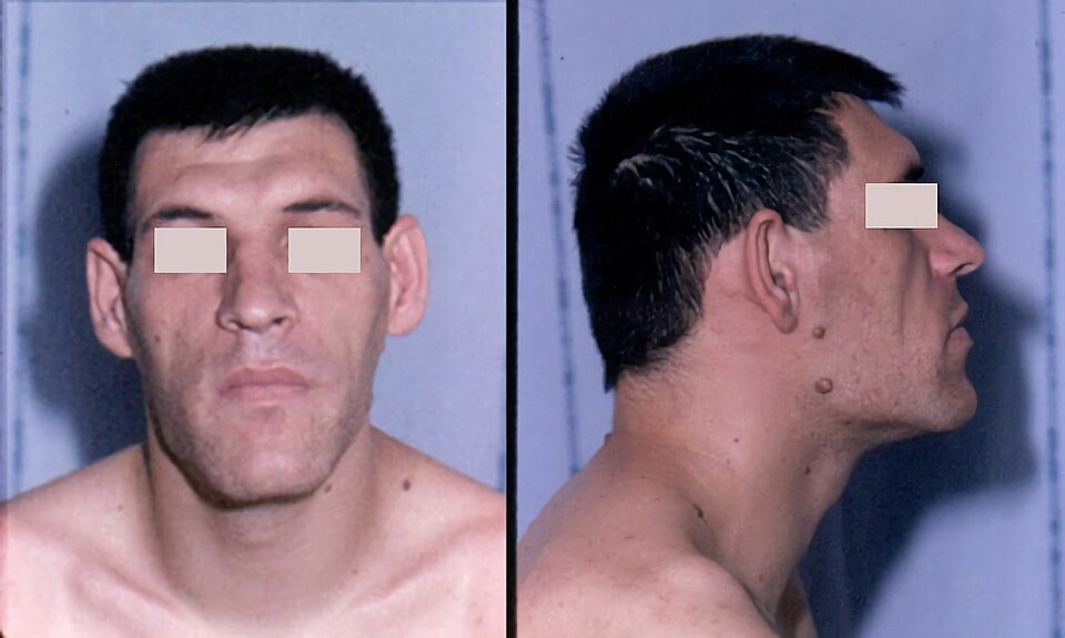 Reference figure for growth hormone