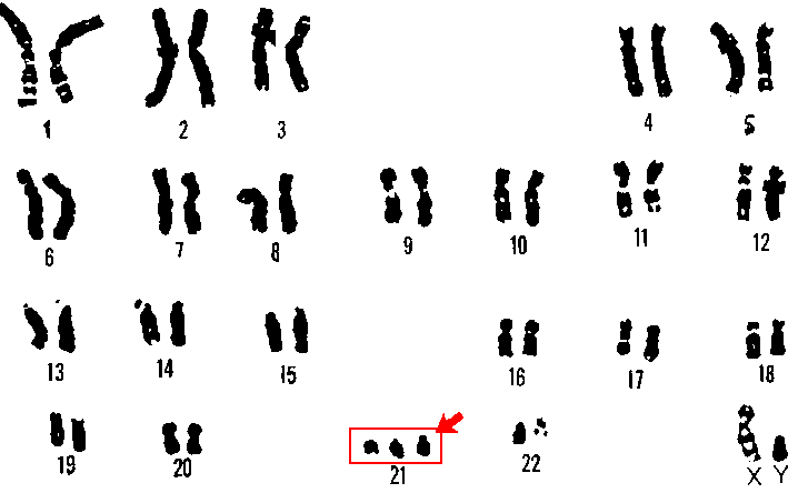 Reference figure: chromosomal disorders