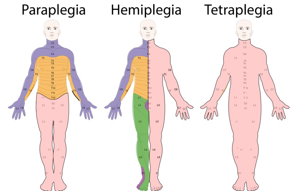 Reference figure for brain and spinal cord injury