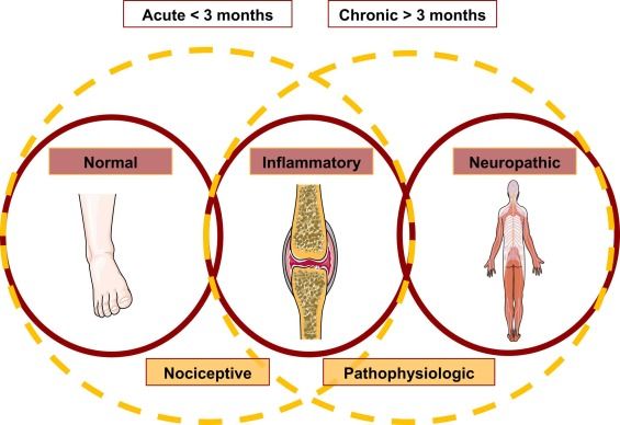 Chart comparing nociceptive pain with neuropathic pain