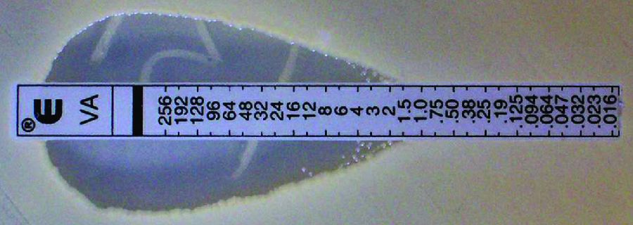 Antimicrobial sensitivity testing strip showing a zone of inhibition and reference figure